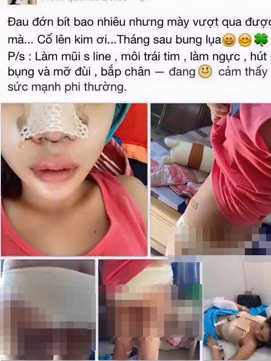 Để cải thiện được nhan sắc, tạo sự tự tin cho bản thân, cô gái trẻ tên Kim ở Hà Nội đã quyết định thực hiện "đại tu" cơ thể với một loạt ca phẫu thuật thẩm mỹ. Quá trình phẫu thuật thẩm mỹ đầy đau đớn được cô gái trẻ công khai trên mạng và khiến nhiều người xem không khỏi rùng mình.