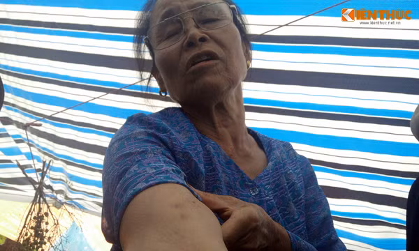 Theo người dân, sáng 3/8, sau khi thấy người dân xã Tân Tiến kéo ra phản đối, phía Công ty Môi trường đô thị Xuân Mai huy động khoảng 70 thanh niên lực lưỡng, xăm trổ đi trên hai chiếc ô tô 45 chỗ cùng nhiều taxi đến và xảy ra đụng độ, hành hung, lăng lạ, chửi bới người dân. Thậm chí, một số người già còn bị những nam thanh niên "hổ báo" bóp tay bầm tím, xô đẩy xuống mương nước dẫn đến bất tỉnh. Tuy nhiên, Chủ tịch UBND xã Tân Tiến - ông Nguyễn Văn Mạnh khẳng định: "Ngay sau khi xảy ra sự việc, cán bộ UBND xã, Công an xã, Công an huyện Chương Mỹ cũng đến hiện trường và thấy người của công ty Môi trường đô thị Xuân Mai và người dân đang tập trung đông dưới chân núi Thoong, giữa hai bên chưa có động thái gì".