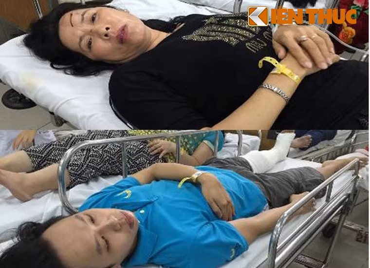 Trần Thị Tám (48 tuổi) và anh Hồ Hữu Lộc (25 tuổi, con trai bà Tám, quê huyện Thanh Bình, tỉnh Vĩnh Long) là 2 trong số các nạn nhân bị thương nặng đang cấp cứu tại BV Chợ rẫy, TP HCM.