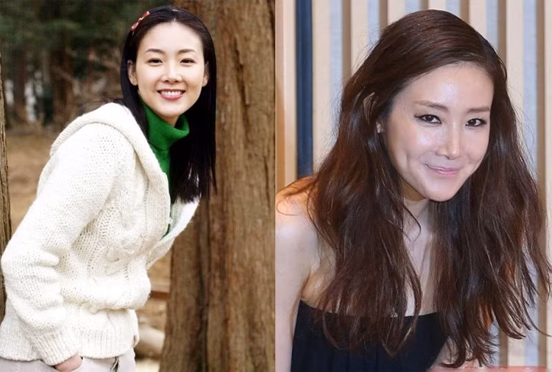 Nghiện dao kéo, mỹ nhân Hàn xuống sắc tệ hại - Hình 5 Nghien dao keo, my nhan Han xuong sac te hai-Hinh-5