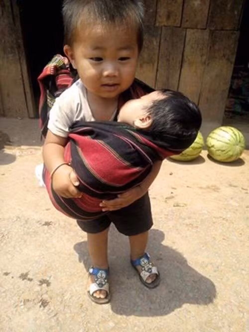 Cam dong hinh anh tieu hoa thuong cham ban bi om