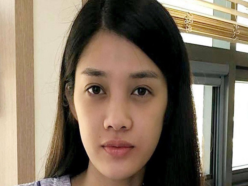 Mới đây, Trình Mỹ Duyên chia sẻ loạt ảnh “đập đi làm lại” gương mặt. Trong ảnh, nữ diễn viên trước khi phẫu thuật thẩm mỹ.