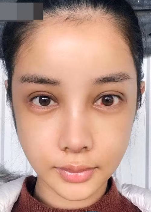 Nữ diễn viên phim "Kiều" giữ kín thông tin “đập đi làm lại” gương mặt suốt 2 năm qua.