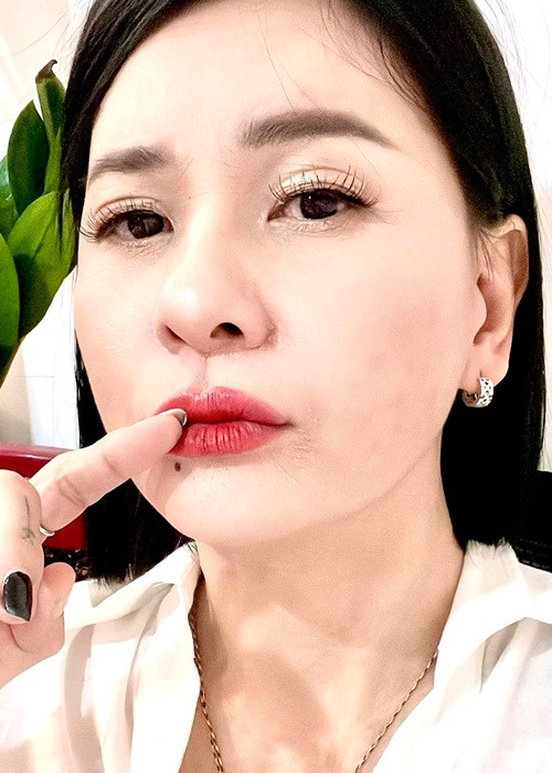 Tình cũ của Kiều Minh Tuấn đăng tải hình ảnh cận mặt và khẳng định chưa bao giờ nhấn mí hay nâng mũi.