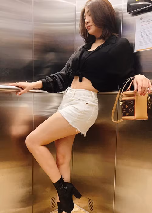 Ngoài sửa ngực, Pha Lê còn hút mỡ ở bụng, lưng để bơm vào vòng ba.