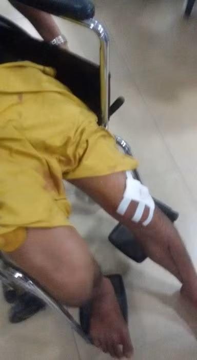 Một nạn nhân bị hung thủ chém vào đầu gối đang được điều trị tại bệnh viện.