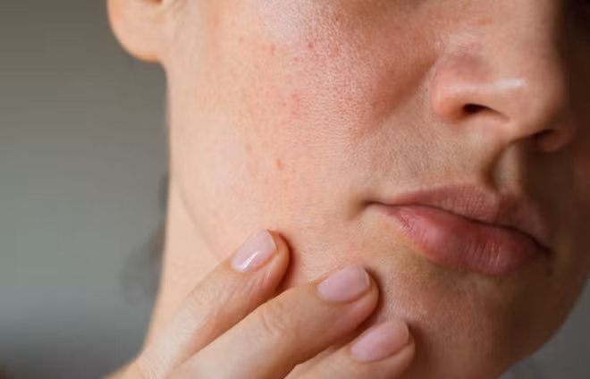 9 ly do khong ngo khien ban gia nhanh hon vao mua dong