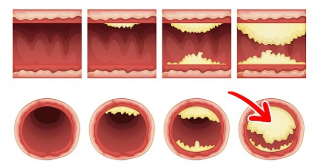 Dieu gi xay ra voi co the neu ban an 2 qua trung moi ngay?-Hinh-6