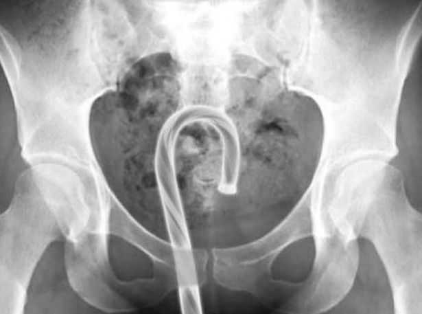 Gap hoa vi dung do trang tri Giang sinh lam do choi nguoi lon