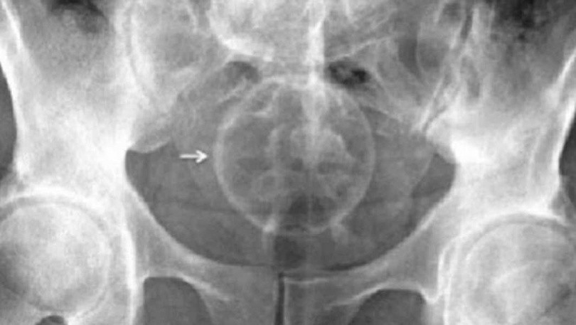 Gap hoa vi dung do trang tri Giang sinh lam do choi nguoi lon-Hinh-2