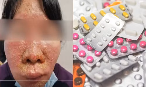 Benh nhan pha lan 7 loai thuoc de uong, bac si het hon