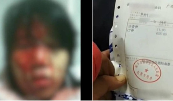 Bo chong dung xeng dap vao dau con dau gay phan no