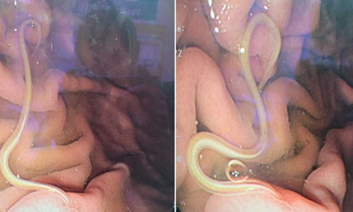 Cu an mon nay la tieu chay, thanh nien tra gia vi so thich