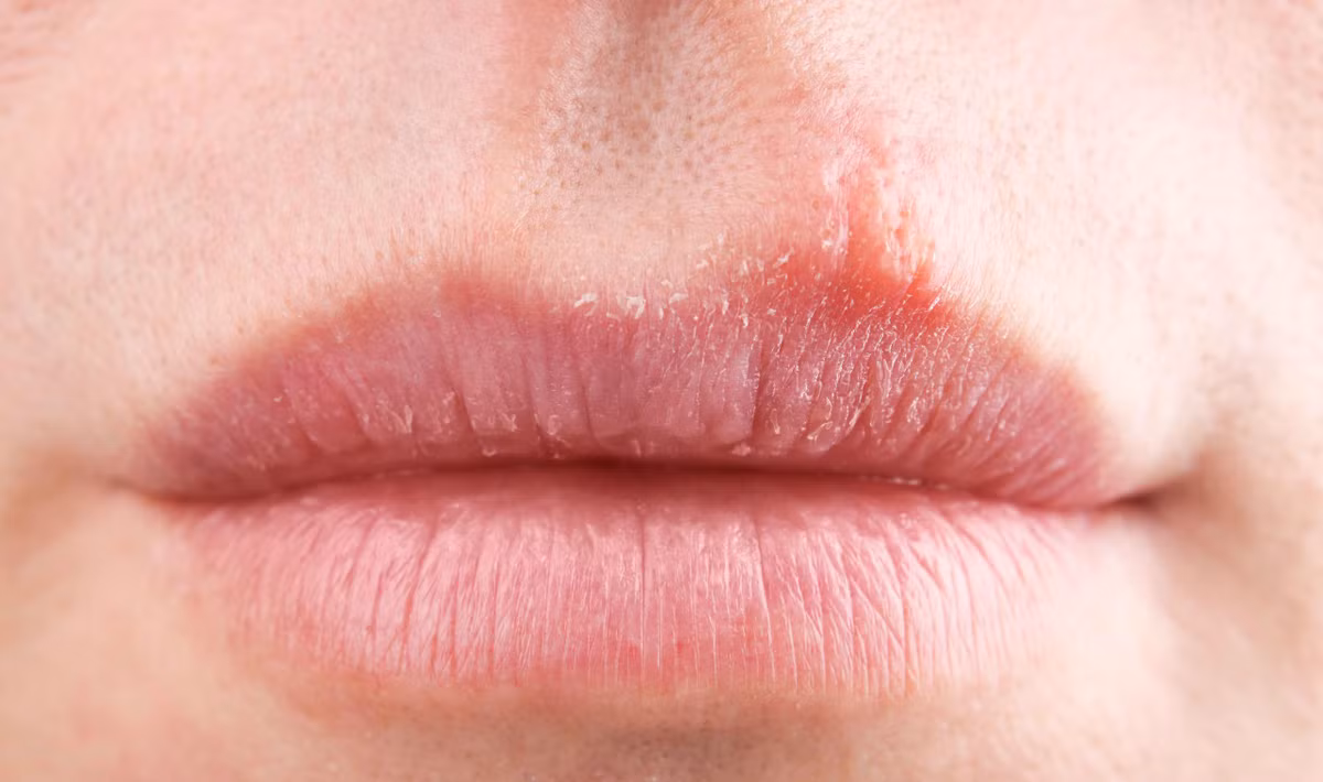 Mau moi tiet lo bat ngo ve suc khoe-Hinh-3