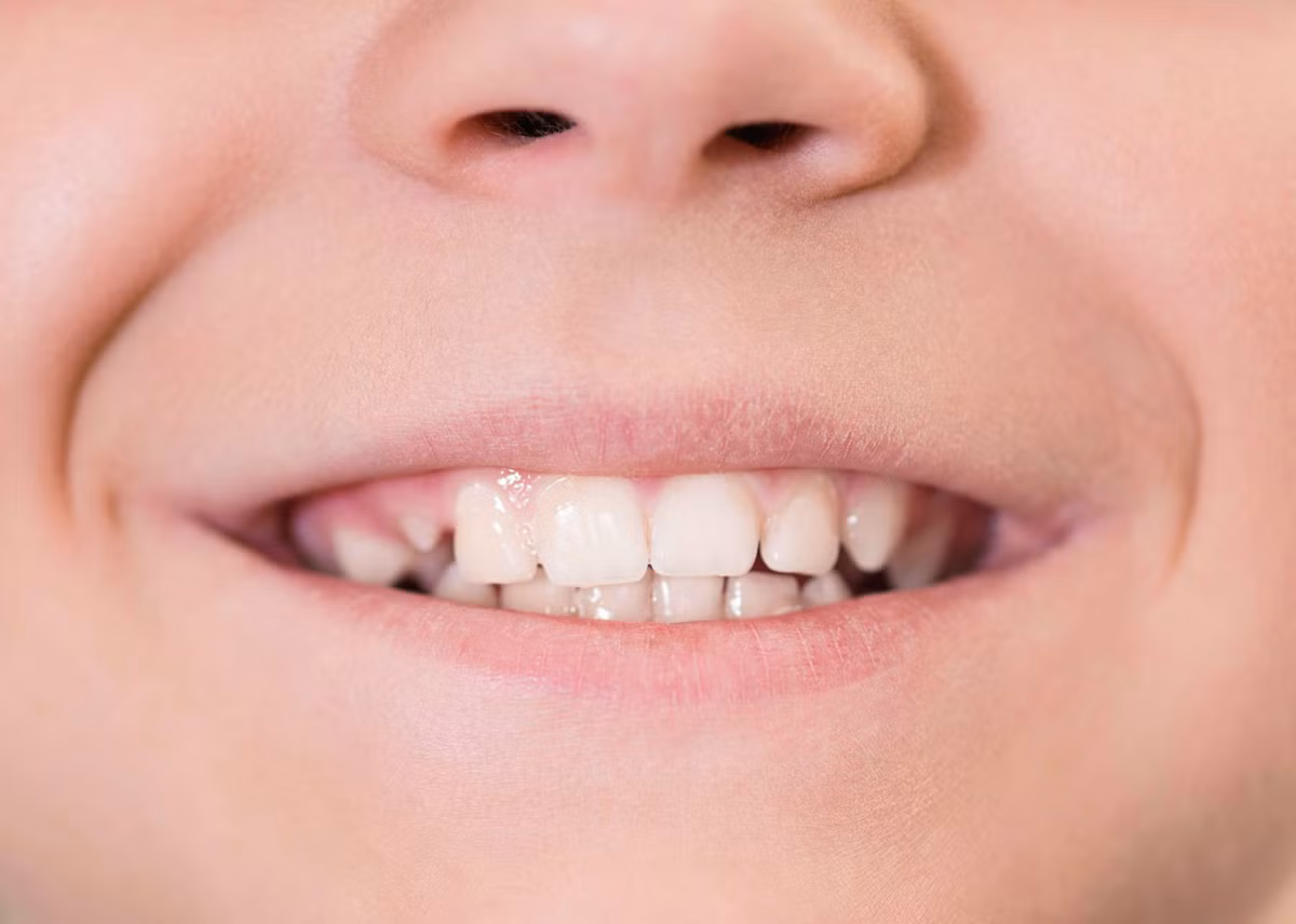 Mau moi tiet lo bat ngo ve suc khoe-Hinh-2