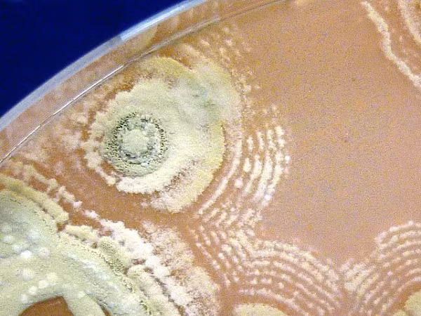 Đó là một loạt nấm và vi khuẩn bao gồm Actinobacteria (vi khuẩn giúp phân hủy vật liệu thực vật) và Firmicutes (giúp tăng trưởng thực vật, kiểm soát mầm bệnh) và nấm men chịu nhiệt Basidioacus hay Penicillium.