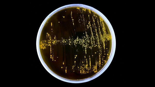 Theo nhóm nghiên cứu dẫn đầu bởi nhà nghiên cứu nấm học Sydney Glassman từ Trường ĐH California ở Riverside (UCR), sau khi quan sát họ nhận thấy rằng dàn sinh vật khác hẳn với những đồng loại của mình.