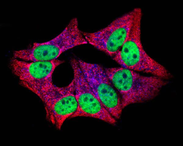 Kể từ sau khi bước sang thế kỷ 21 tới nay, đã có 5 công trình nghiên cứu dựa trên tế bào Hela đoạt giải Nobel. Và tiến sĩ Aubrey de Grey cho rằng nếu khám phá được bí mật của tế bào Hela, con người có thể sống tới 1.000 tuổi.
