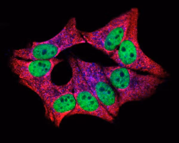 Kể từ sau khi bước sang thế kỷ 21 tới nay, đã có 5 công trình nghiên cứu dựa trên tế bào Hela đoạt giải Nobel. Và tiến sĩ Aubrey de Grey cho rằng nếu khám phá được bí mật của tế bào Hela, con người có thể sống tới 1.000 tuổi.