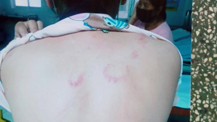  Chồng dùng thắt lưng quật vợ nhập viện: Ngày 15/5, Trần Văn Nam (35 tuổi, ngụ huyện Đức Hòa, tỉnh Long An) nghi ngờ vợ là chị Trần Thị Mộng Nghi (34 tuổi, quê huyện Tân Trụ) điện thoại cho bạn gái của Nam nên hạch hỏi, kiếm chuyện gây sự. Thấy vợ không trả lời, Nam rút dây thắt lưng quật liên tục vào đầu, vào người của chị Nghi, gây chấn thương nặng. Ngày 21/5, Công an huyện Đức Hòa cho biết đang điều tra làm rõ vụ việc.