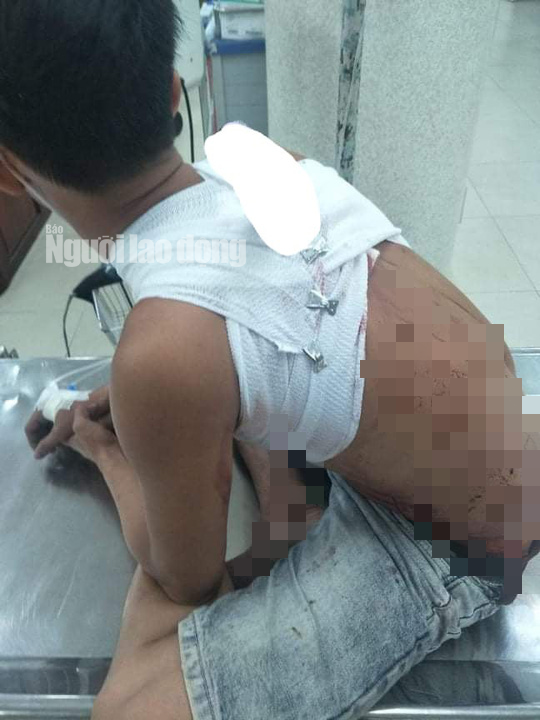  Bị đâm dã man vì bạn nhậu... xin về sớm: Ngày 24/2, anh Ngô Minh Lộc (SN 1990, Chợ Gạo, Tiền Giang) tổ chức uống bia tại nhà. Bữa tiệc kéo dài nhiều giờ, Nguyễn Hoàng Ân (SN 1990) xin dừng để ra về vì không uống bia được nữa. Sau đó, Ân và Bùi Tấn Giang (SN 1993) phát sinh mâu thuẫn. Ân đánh Giang, Nguyễn Minh Kiểng (SN 1997) dùng hung khí tấn công Giang. Để giải vây cho bạn, Nguyễn Thanh Phong (SN 2000) dùng dao đâm vào vai Kiểng. Hậu quả, Giang, An và Kiểng phải vào viện cấp cứu. 