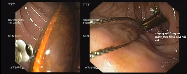 Kinh hai di vat nam suot 20 nam trong ta trang nam thanh nien