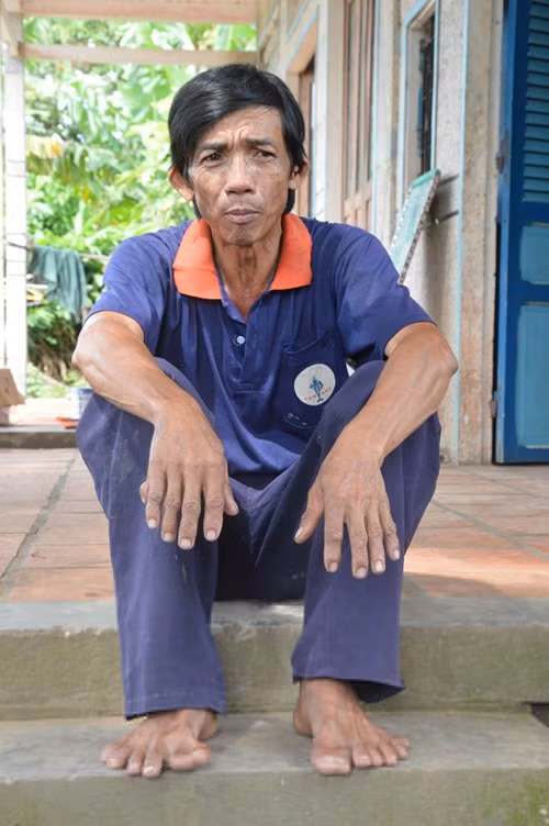 Tan mat nguoi dan ong co 25 ngon tay, chan o Dong Thap-Hinh-3