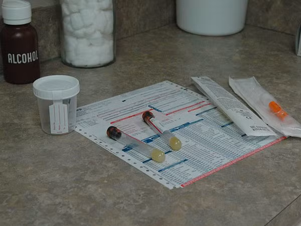 Xét nghiệm nước tiểu: Để loại bỏ lượng đường trong máu cao, protein cao và sự hiện diện của các bệnh nhiễm khuẩn như nhiễm trùng đường tiết niệu, bạn nên làm xét nghiệm nước tiểu.