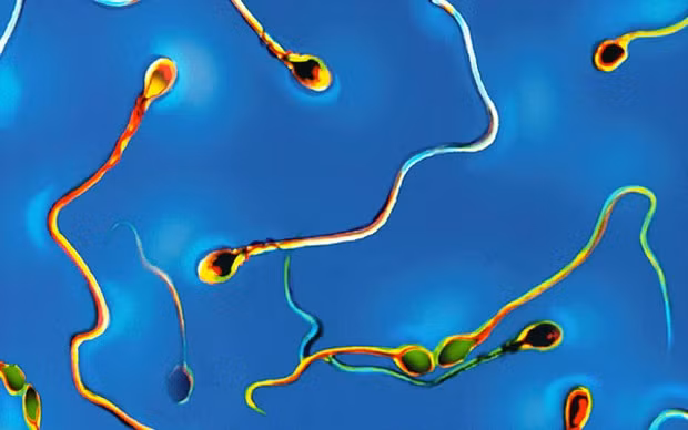 Việc phân tích tinh dịch sẽ giúp xác định được liệu nam giới có phải là yếu tố liên quan đến nguyên nhân gây vô sinh của một cặp vợ chồng.