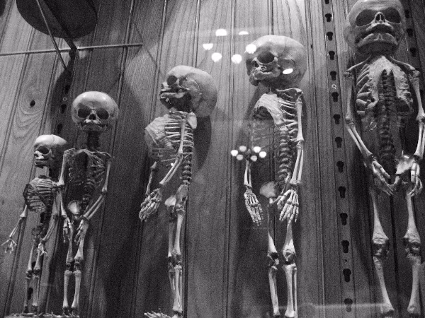 Bảo Tàng The Mutter – Philadelphia, Pennsylvania, Mỹ Bảo tàng The Mutter được thành lập vào năm 1858, là nơi trưng bày các mẫu vật về bệnh lý dị dạng.