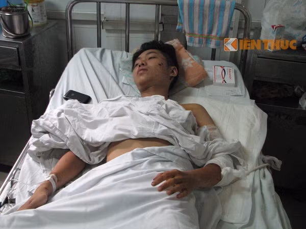 Nan nhan vu no lon o ngo Thong Phong ke phut gap hoa