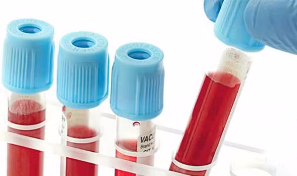 Nếu có một chiến lược khám sức khỏe định kỳ, bạn sẽ được phát hiện bệnh sớm bằng các test sàng lọc. Ví dụ: ung thư vú, ung thư cổ tử cung, ung thư tuyến giáp...