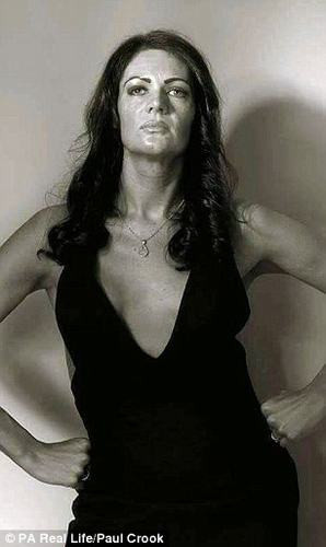 Sau khi biết mình bị ung thư vú, Emma đã rất choáng váng và thất vọng. Bởi trước kia, cô từng đi xét nghiệm và không tìm thấy một khối u hoặc có bất kỳ triệu chứng của bệnh ung thư vú.