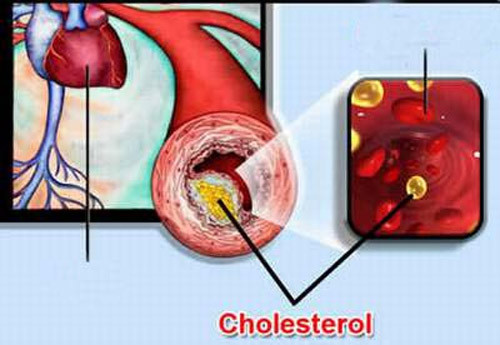 Giảm cholesterol. Bột tỏi có nhiều lợi ích đối với sức khỏe. Nó đặc biệt có hiệu quả trong việc giúp giảm LDL (cholesterol xấu) và làm tăng HDL (cholesterol tốt) trong cơ thể. 