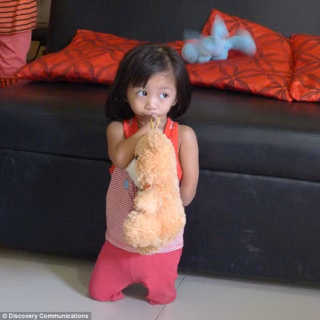 Nu cuoi ban linh cua co be khong mieng, khong tay chan-Hinh-4