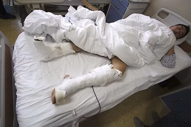 Nhặt đồ chơi (Bắc Kinh, Trung Quốc): Tháng 1/2009, một du khách ở sở thú Bắc Kinh đã nhảy vào chuồng gấu trúc để nhặt món đồ chơi con trai đánh rơi. Anh bị con gấu trúc nặng hơn 100 kg tên Gu Gu cắn vào chân. Nhân viên sở thú đã phải dùng dụng cụ để Gu Gu nhả chân người đàn ông ra. Trước đó, Gu Gu cũng đã tấn công hai người vào chuồng mình. Ảnh: Nydailynews.