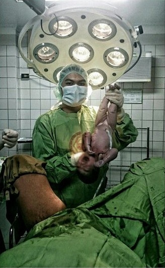 Bác sĩ sản khoa tự sướng lúc đỡ đẻ: Gần đây, một số vị y, bác sĩ dường như đang lây truyền cho nhau trào lưu chụp ảnh "tự sướng" trong lúc đỡ đẻ rồi tung lên mạng xã hội. Trong những bức ảnh này thậm chí còn xuất hiện cả vùng kín của người phụ nữ và phần đầu đang chòi ra của đứa trẻ sơ sinh. Sự việc này đã gây ra một cuộc tranh cãi gay gắt về "cái gọi là y đức" của một bộ phận y - bác sĩ ở các phòng khám phụ sản.