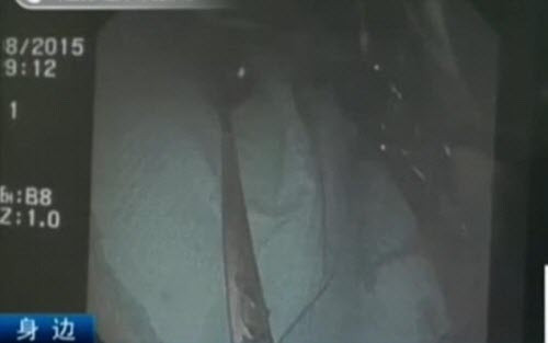 An quá nhanh, co gái bị hóc cả cái thìa dai 15cm