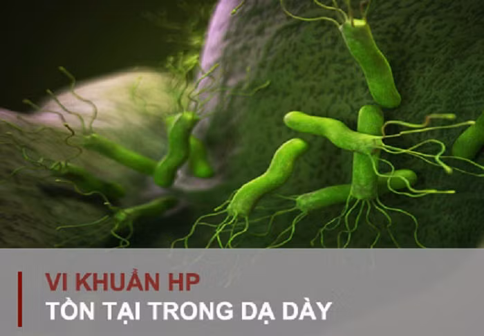 Viêm teo niêm mạc dạ dày thường do vi khuẩn H. pylori gây ra. Vi khuẩn này có khả năng phá vỡ lớp màng nhầy bảo vệ niêm mạc dạ dày khỏi tác động từ dịch vị – dịch tiêu hóa có tính axit do một số tế bào dạ dày tiết ra để tiêu hóa thức ăn. Viêm nhiễm dần dần phá hủy các tế bào niêm mạc dạ dày nếu không được điều trị triệt để.