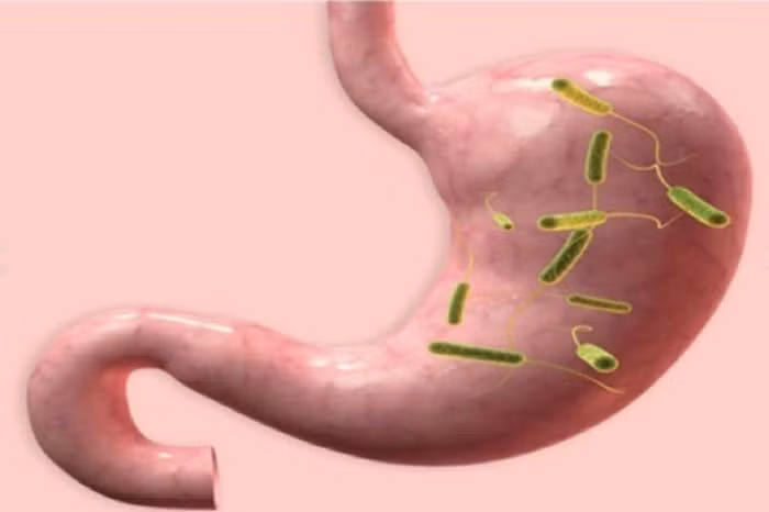 Người nhiễm khuẩn H.P. Vi khuẩn H.P (Helicobacter pylori) sống trong dạ dày, dưới lớp nhầy niêm mạc dạ dày, sát cạnh các tế bào biểu mô, không xâm nhập các mô.