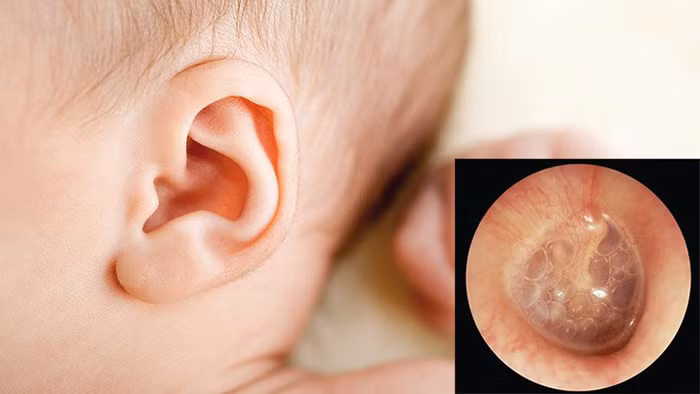 Cấu tạo tai khiến trẻ không thể đưa sâu tay vào trong tác động. Chính vì vậy, con chỉ biết bứt vành tai bên ngoài để biểu hiện sự khó chịu.