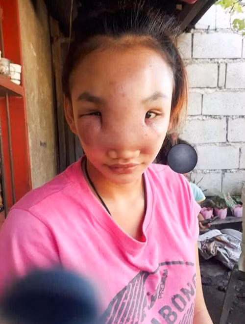 Sai lam nan mun, gai xinh mu loa, dau don song khong bang chet