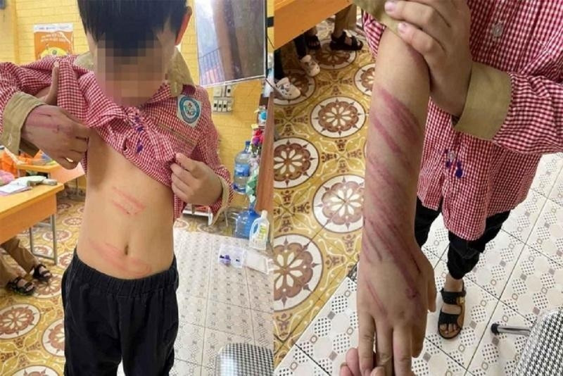 “Bo ho” bao hanh be trai 8 tuoi khai gi?