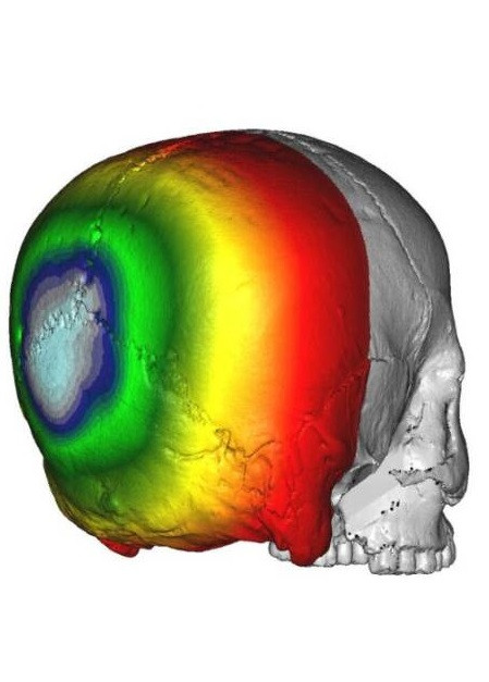 Một giả thuyết cho rằng, họ làm như vậy để tạo ra sự khác biệt với các cộng đồng khác. Do đây chỉ là giả thuyết nên các chuyên gia sẽ cần tiến hành những nghiên cứu sâu hơn nhằm giải mã bí ẩn này.