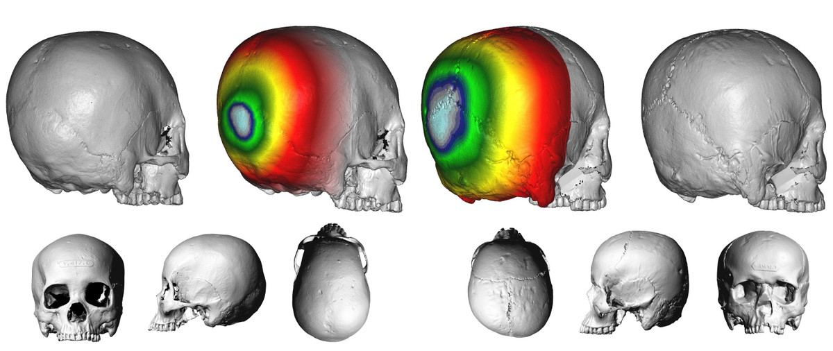 Thông qua các phân tích, kiểm tra, nhóm nghiên cứu phát hiện hầu hết các hộp sọ đều bị biến dạng một cách có chủ ý.