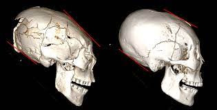 Nghiên cứu của các chuyên gia cho thấy tại vùng Houtaomuga, người quá cố được chôn cùng với những của cải quý giá cho thấy họ là những người có địa vị cao trong xã hội.