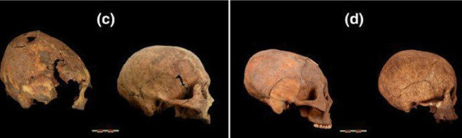 Không chỉ Trung Quốc, tập tục kéo dài hộp sọ được nhiều nền văn minh cổ xưa thực hiện với những mục đích khác nhau.