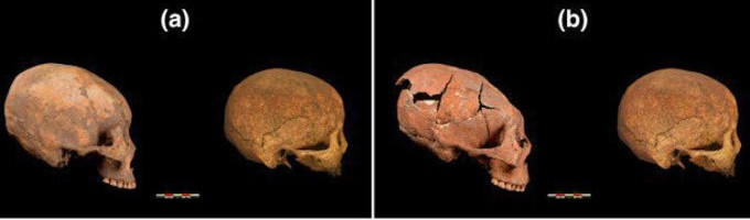 Những người này có phần hộp sọ được kéo dài trông giống như quả trứng cho thấy tập tục này có thể chỉ được thực hiện ở tầng lớp quý tộc, giàu có. Điều này giống như một cách họ thể hiện địa vị của mình.