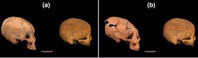 Những người này có phần hộp sọ được kéo dài trông giống như quả trứng cho thấy tập tục này có thể chỉ được thực hiện ở tầng lớp quý tộc, giàu có. Điều này giống như một cách họ thể hiện địa vị của mình.