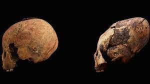 Việc thực hiện tập tục kéo dài hộp sọ này không ảnh hưởng tiêu cực đến khả năng nhận thức và phát triển của trẻ em.